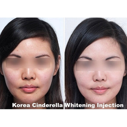 Cindella Skin Whitening Set - XQ Shop