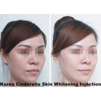 Cindella Skin Whitening Set - XQ Shop