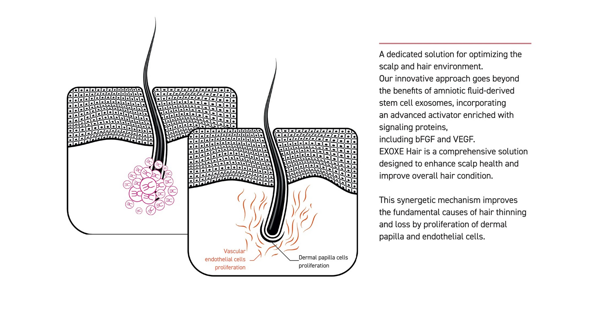 EXOXE Hair - XQ-Shop