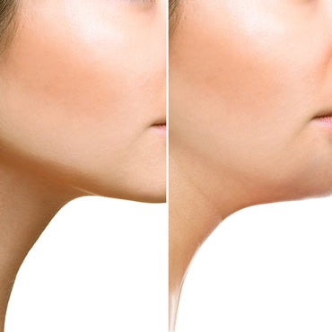 Pluryal Mesoline FaceContour