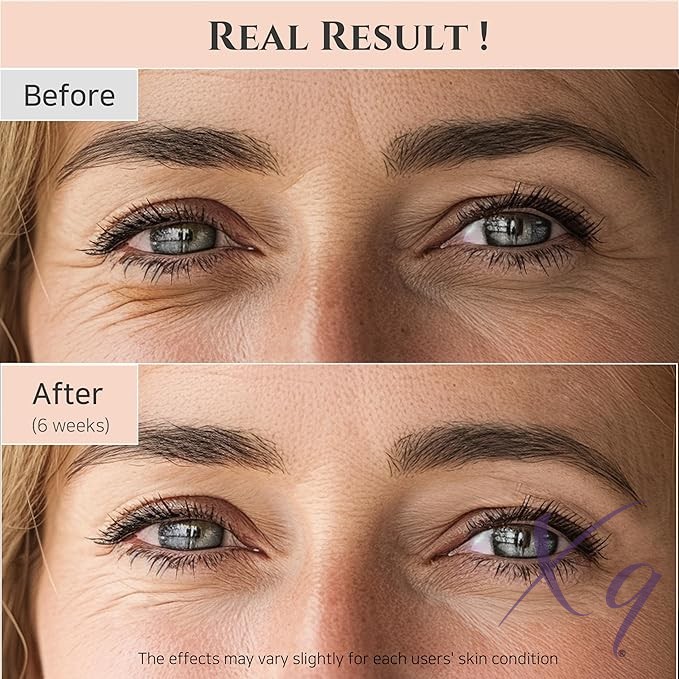Beauty of Joseon - Revive Eye Serum w. Ginseng + Retinal 30ml Xq-VIP