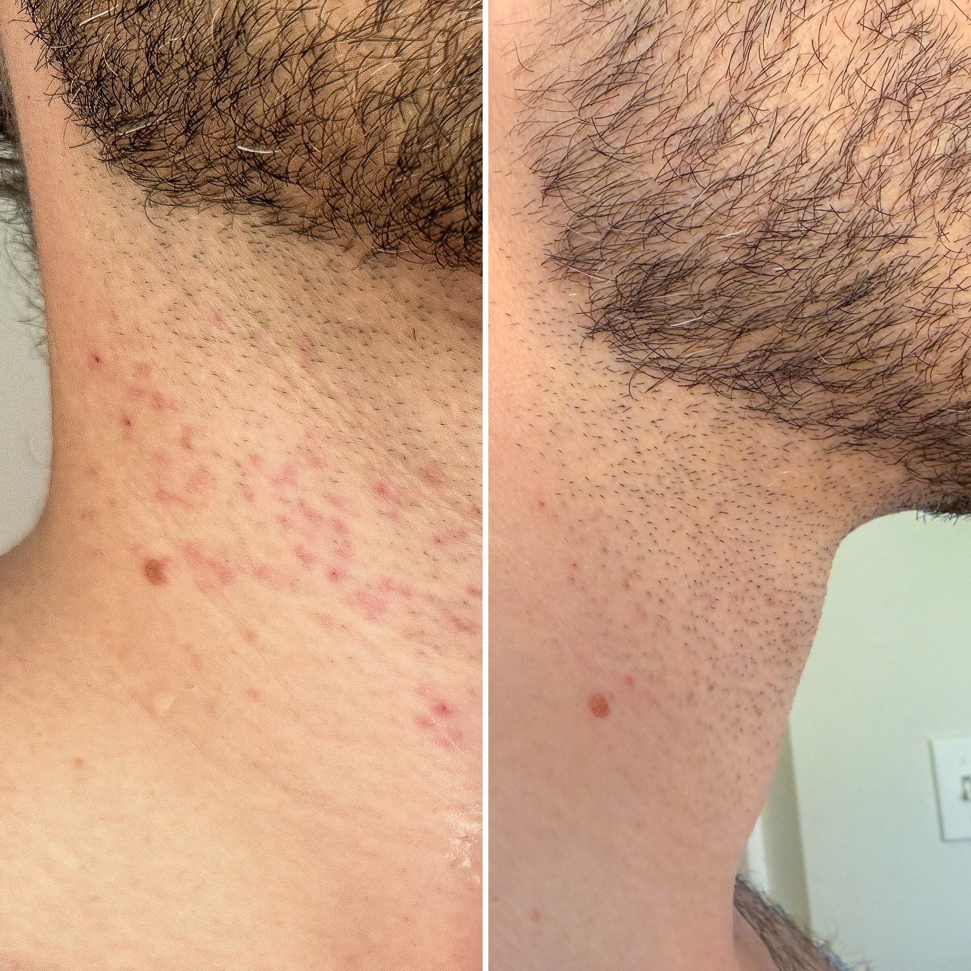 BRUH. - The Recovery Mist 4 fl.oz. Xq-VIP