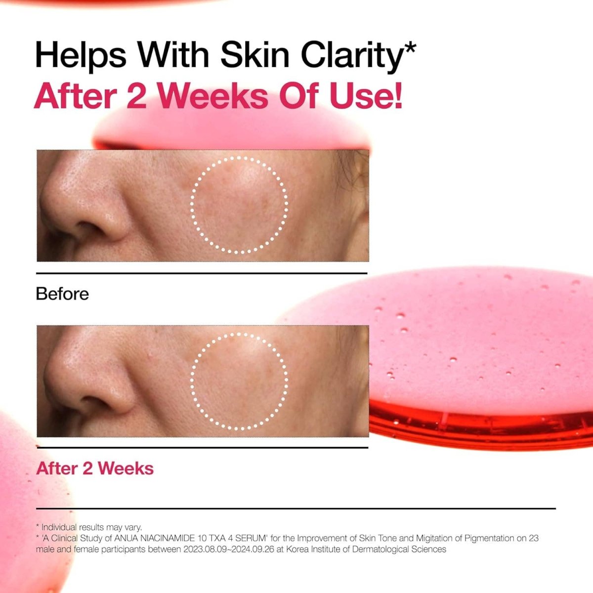 Anua - 10% Niacinamide+ 4% Tranexamic Acid Serum (30ml /1.01 fl.oz.) 5Xq-VIP Anua - 10% Niacinamide+ 4% Tranexamic Acid Serum (30ml /1.01 fl.oz.) - Image 5