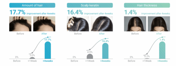 Velash EXO PLUS Hair Scalp Treatment - Image 3