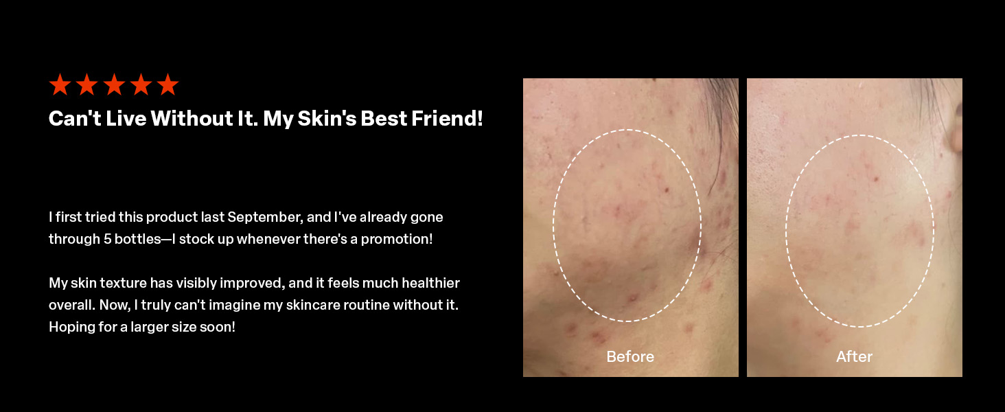 PURCELL Pixcell Biom 2B/mL- Topical Probiotic Drop 30mL Xq-VIP