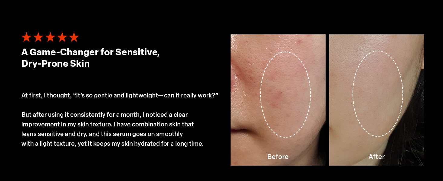 PURCELL Pixcell Biom 2B/mL- Topical Probiotic Drop 30mL Xq-VIP