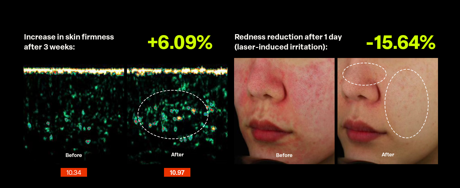 PURCELL Pixcell Biom 2B/mL- Topical Probiotic Drop 30mL Xq-VIP