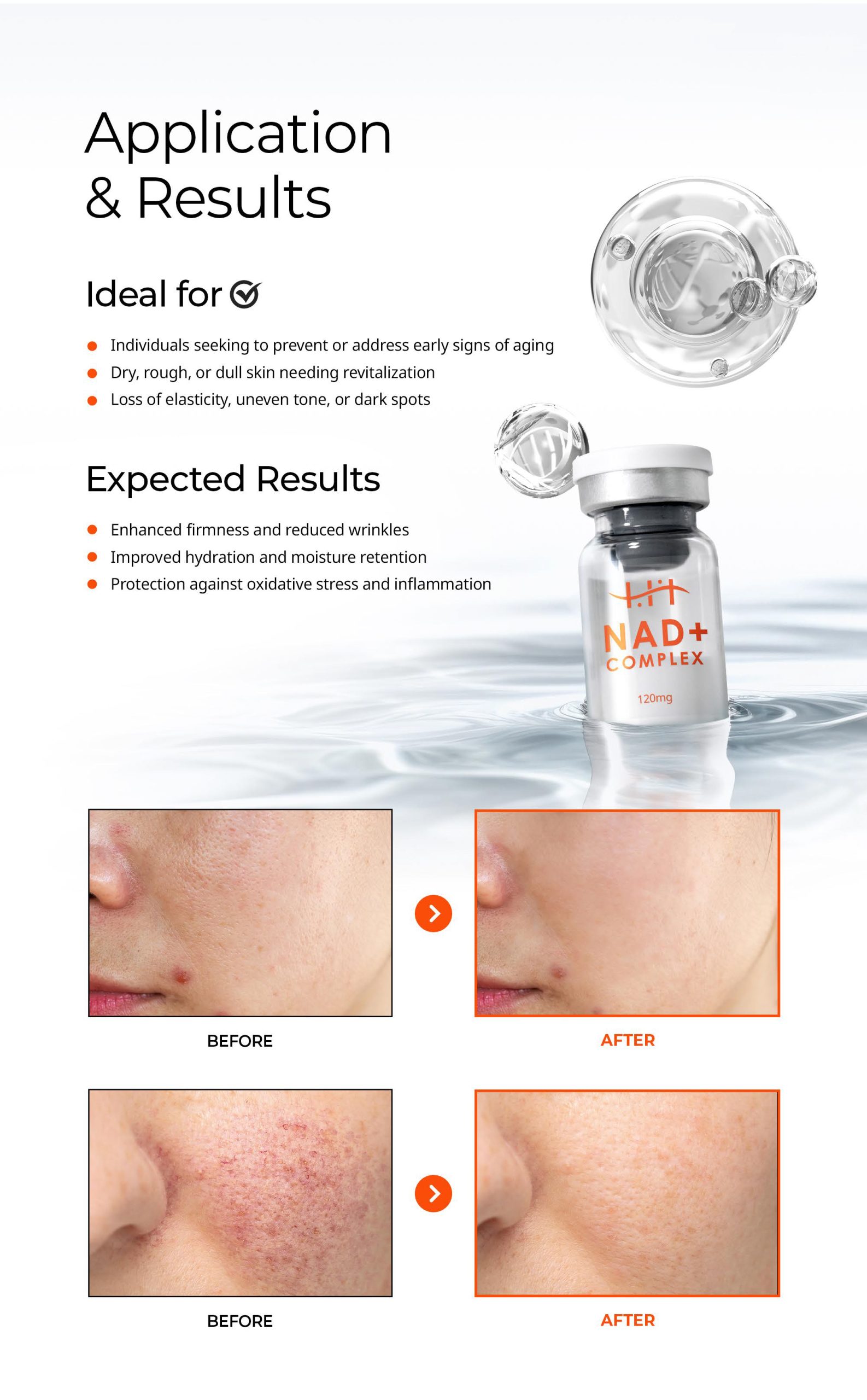 HANHEAL - NAD+ Complex Skin Booster Xq-VIP