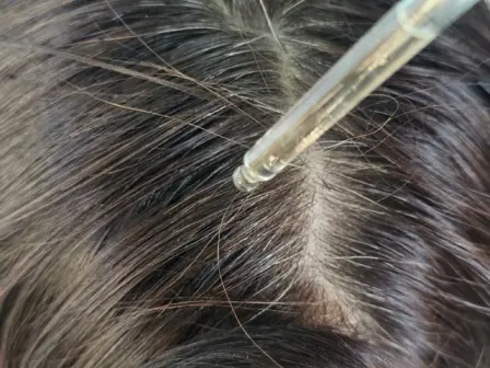 💥 Women Don’t Go Bald… Right?