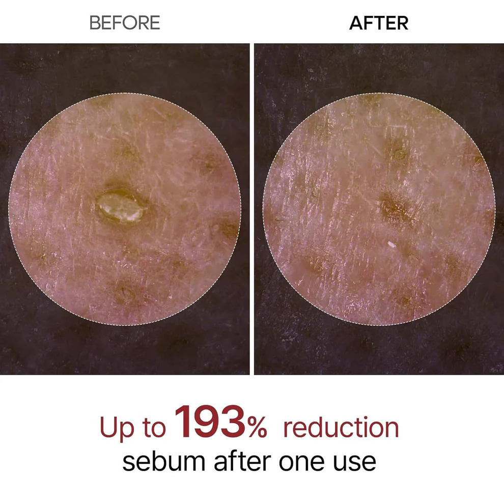 Dr.Melaxin - Peel Shot Glow White Rice Peeling Ampoule 80ml - Image 7