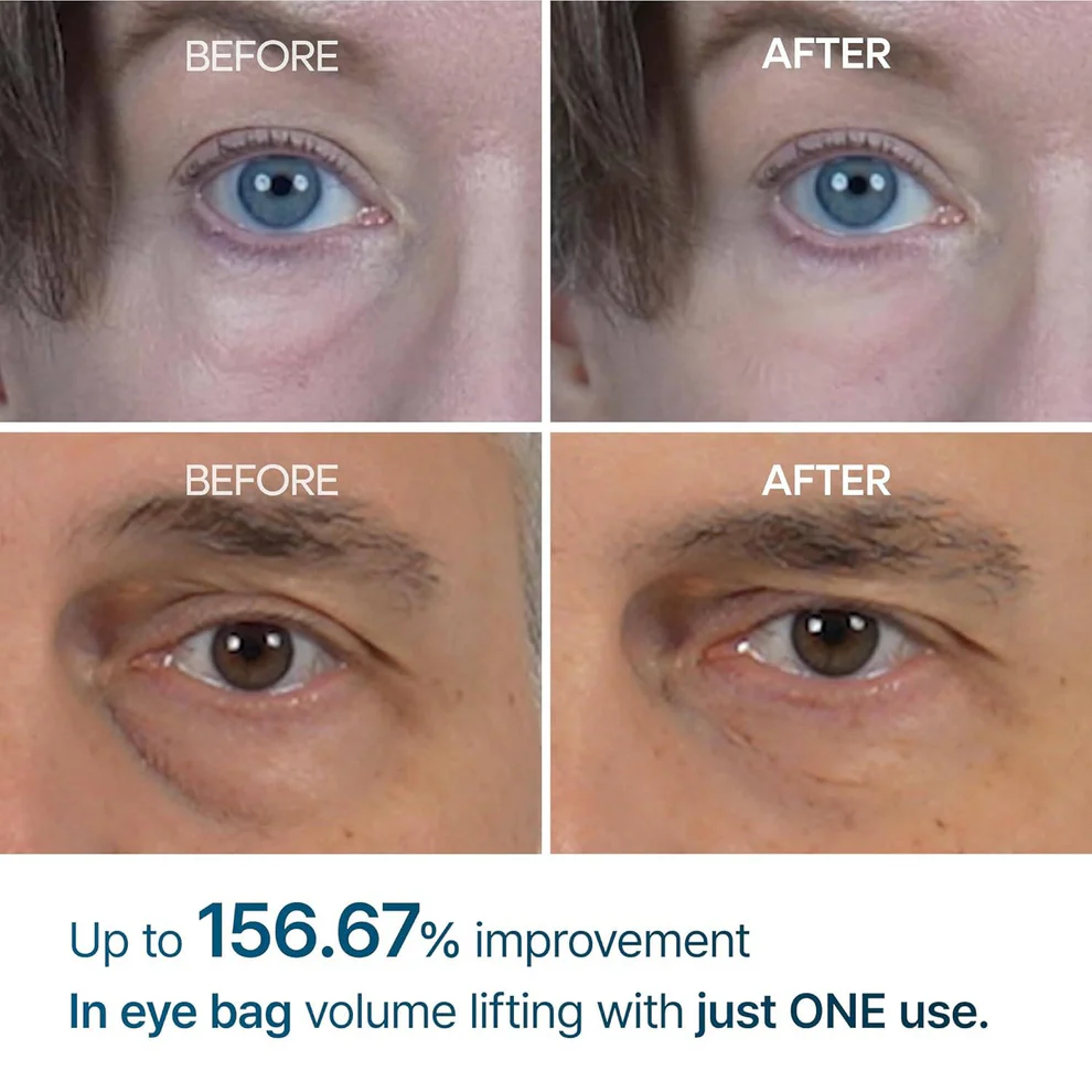 Dr.Melaxin - Eyephalt Eyebag Cream 10ml - Image 3
