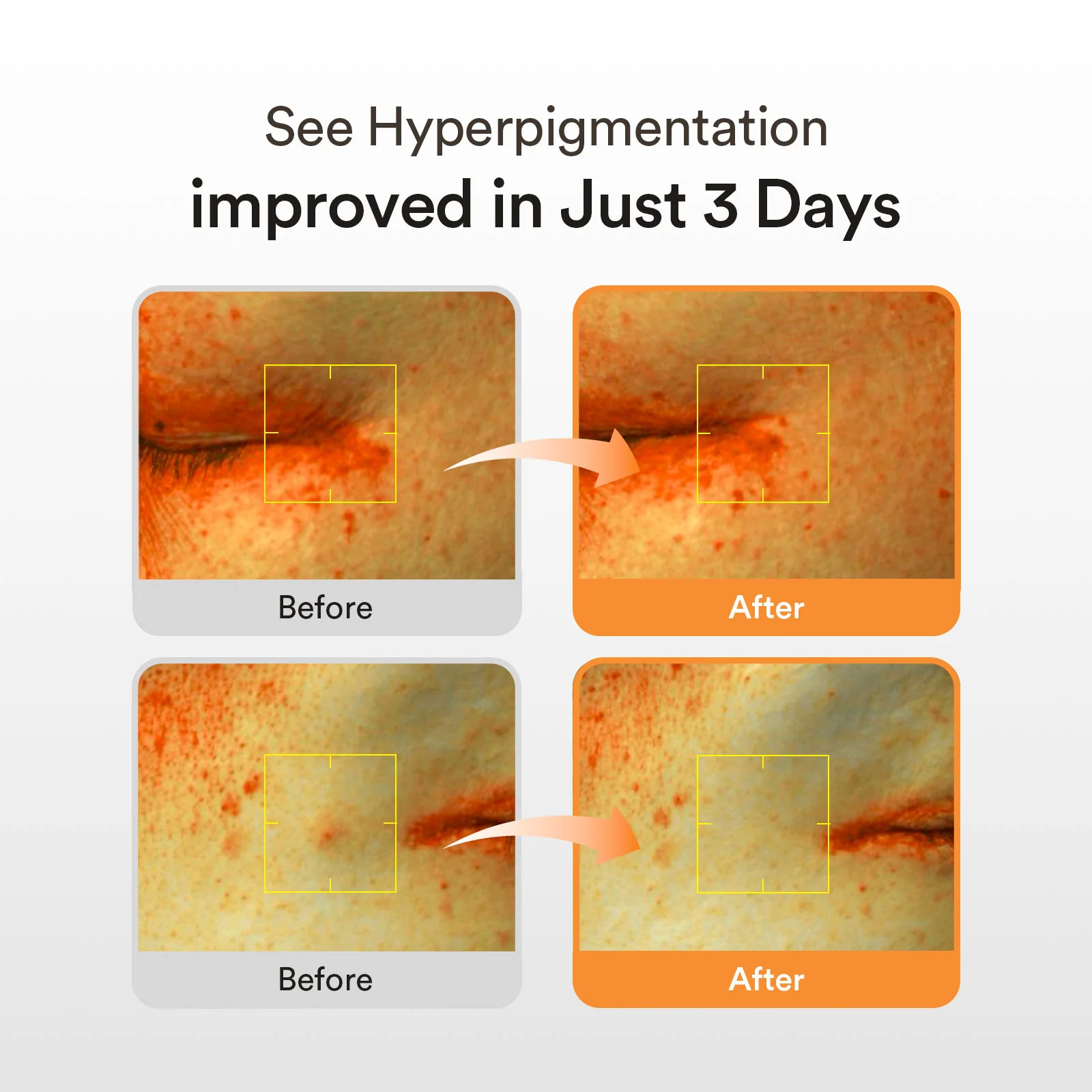 Glutathiosome Dark Spot Serum Vita Drop - Image 5