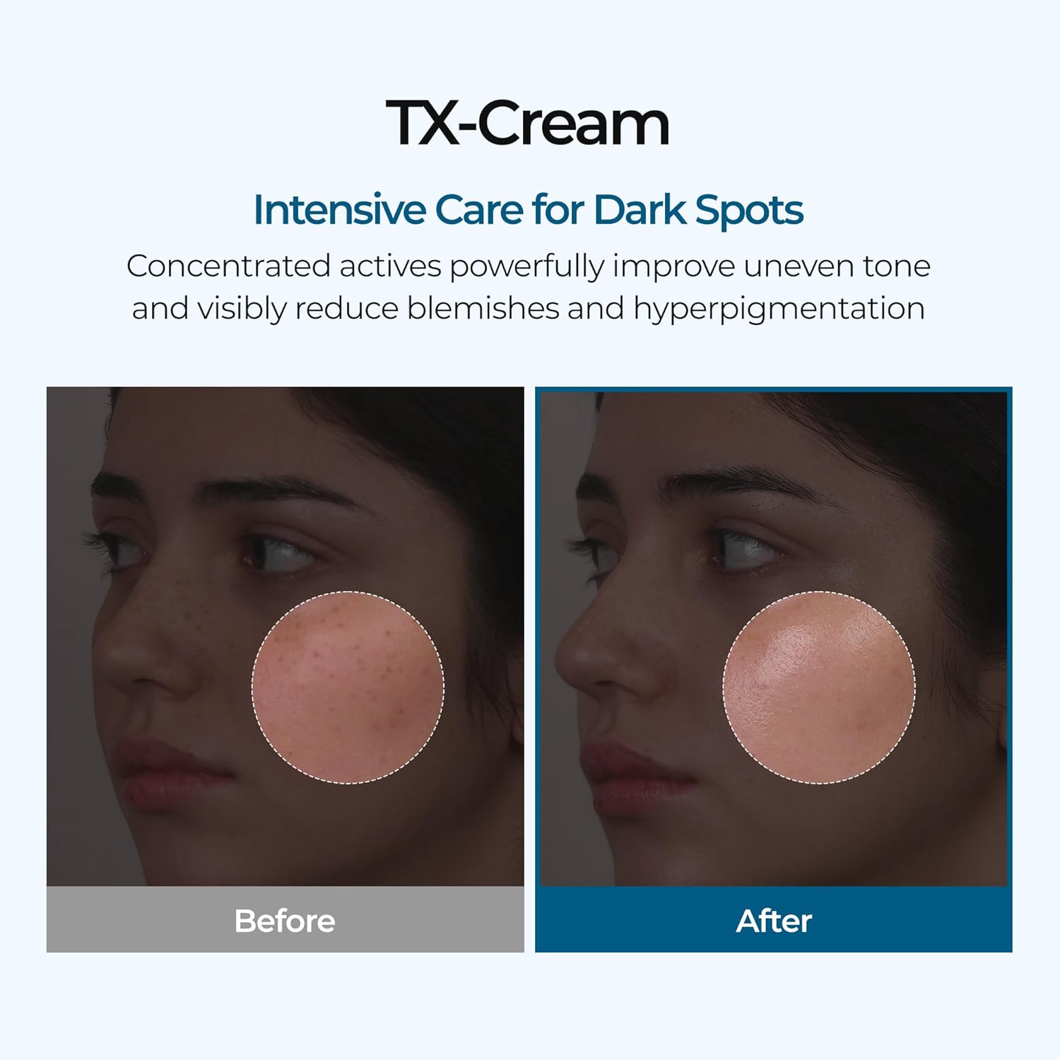 Dr. Melaxin - TX Cream 50mL - Image 7