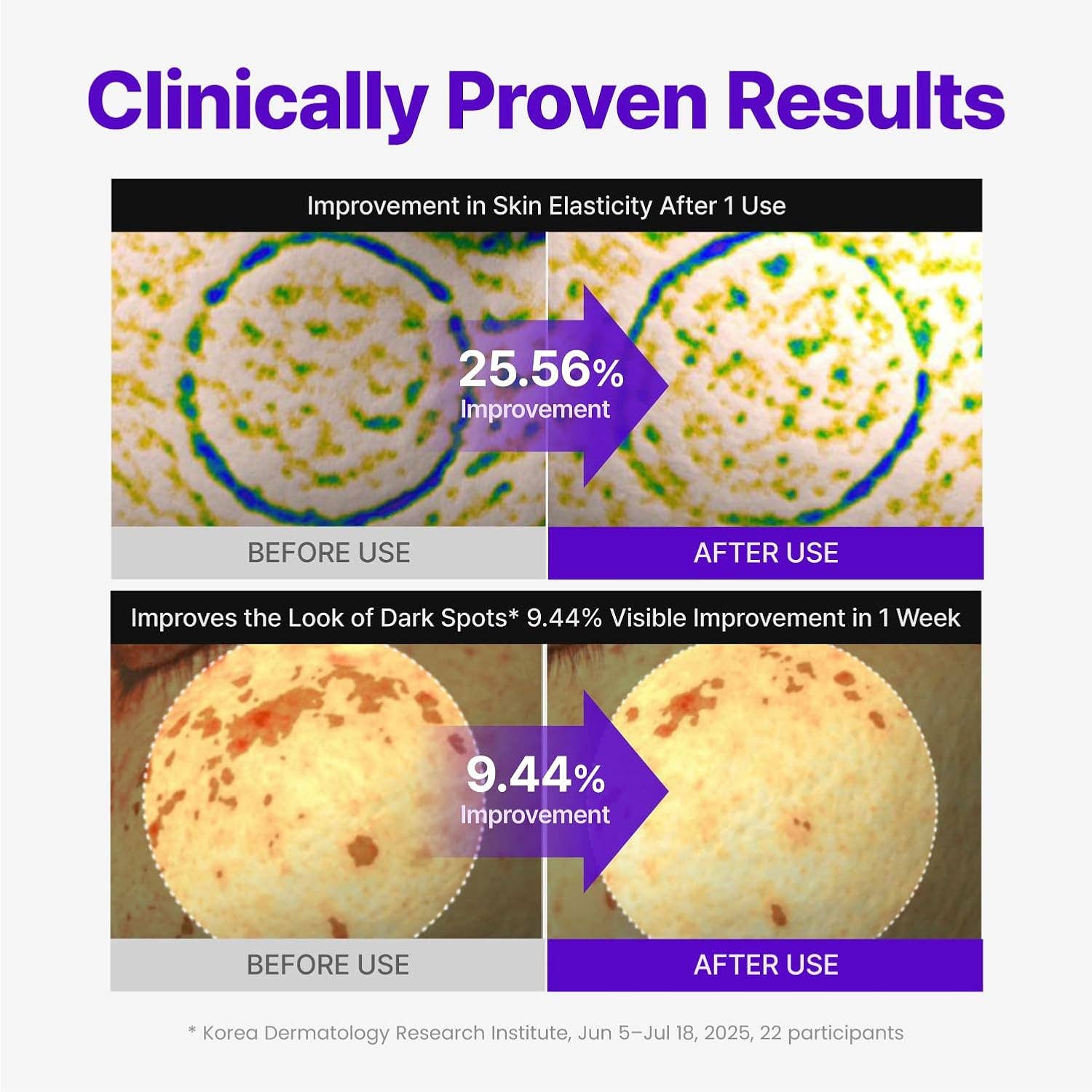 CENTELLIAN 24 Expert Madeca Cream Active Renew PDRN - Image 3